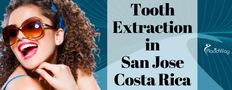 Tooth Extraction in San Jose, Costa Rica